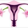 DIETA PRZY ZESPOLE POLICYSTYCZNYCH JAJNIKÓW (PCOS- polycystic ovary syndrome)