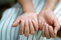 Białe plamki na paznokciach nie zawsze oznaczają poważną chorobę.