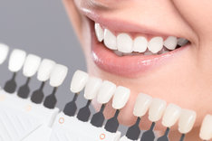 Wybielanie zębów w domu jest równie skuteczne, jak zabieg stomatologiczny.