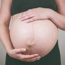 Domowe sposoby na rozjaśnienie rozstępów